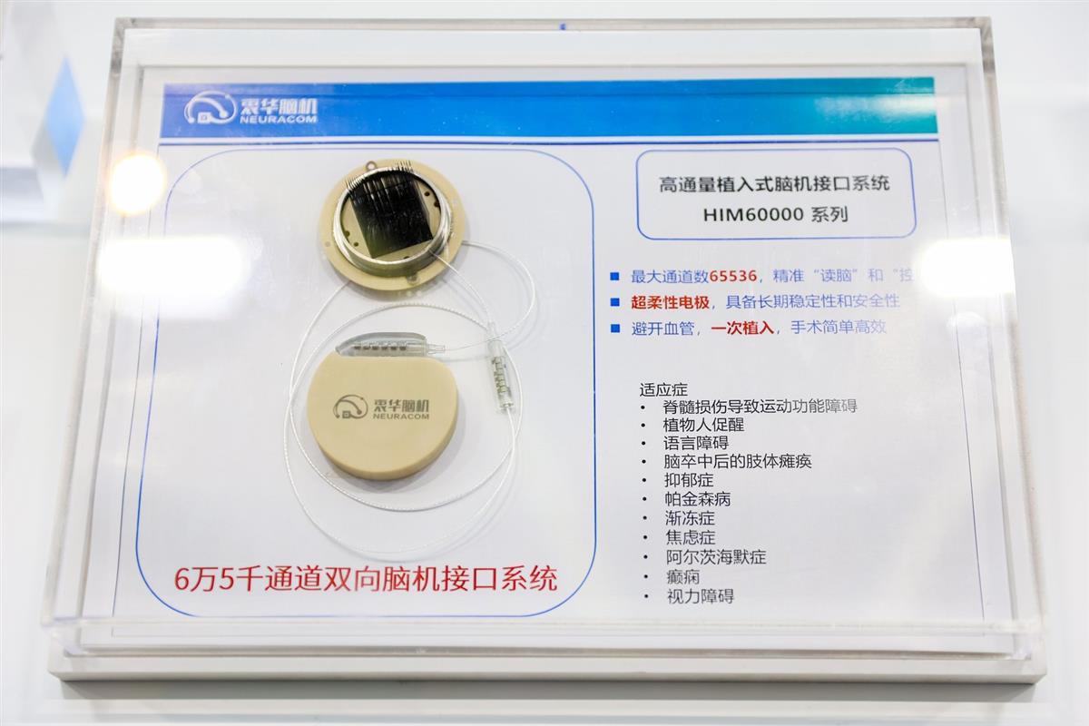 全国产自主可控脑机接口“中国芯”首次测试患者(图3)