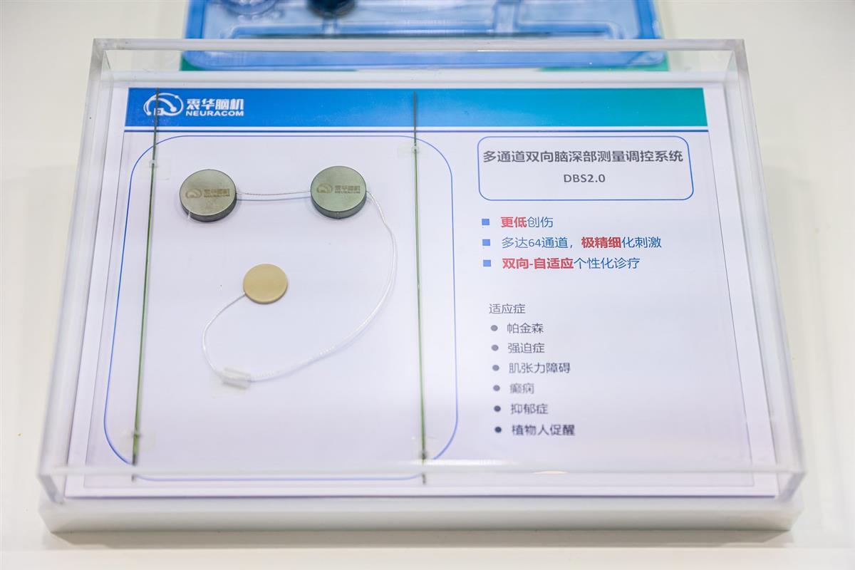 全国产自主可控脑机接口“中国芯”首次测试患者(图4)