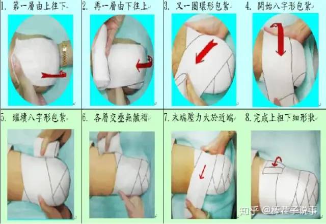 河南假肢下肢安装注意事项