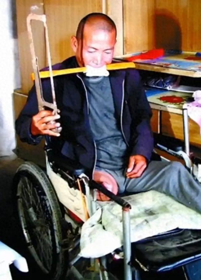 因拿不出100万手术费河南一农民徒手锯掉自己右腿如今他咋样(图1)