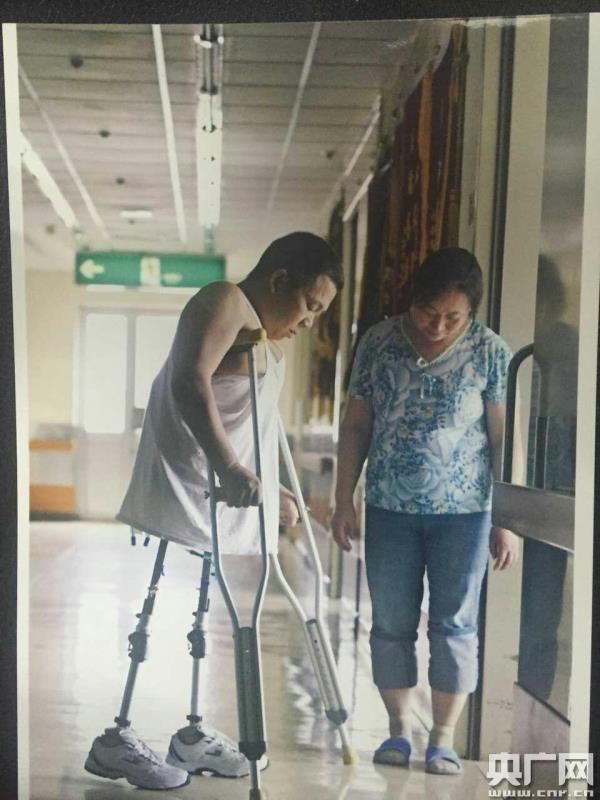 假肢矫形进入3D时代 小伙带上假肢能打球(图1)