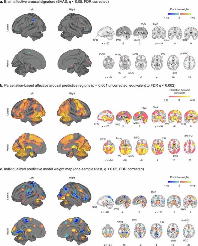 追问daily 为何很多事情睡一觉就好；大脑冒险机制与童年资源有关；小脑或将成为控制假肢的新大脑(图2)