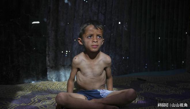 加沙饥饿婴儿画面曝光营养不良死亡数万网友 来卖惨当寄生虫(图4)