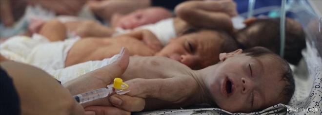 加沙饥饿婴儿画面曝光营养不良死亡数万网友 来卖惨当寄生虫(图17)