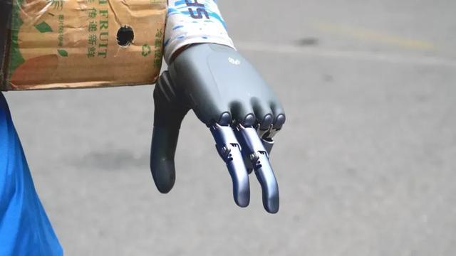 残疾快递小哥装上智能义肢(图4)