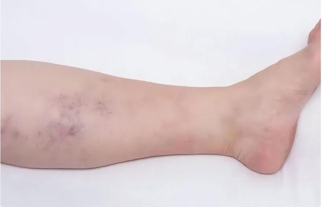 2012年河北女孩7年花200万抗癌亲友劝放弃怒道：我凭啥该死(图19)