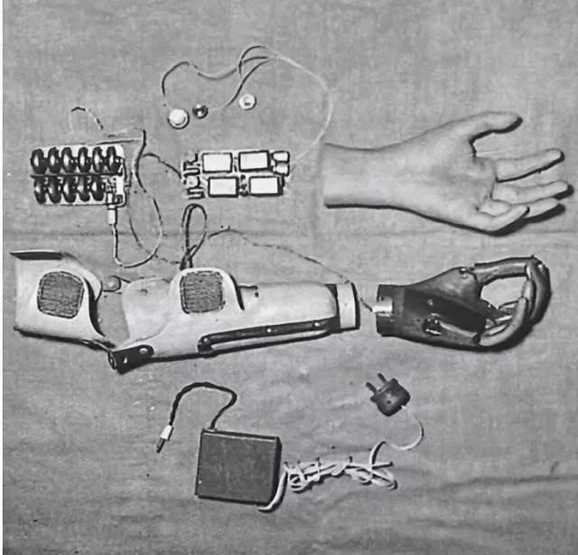 概念圈︱上市公司下场角逐肌电控制假肢价值凸显(图3)