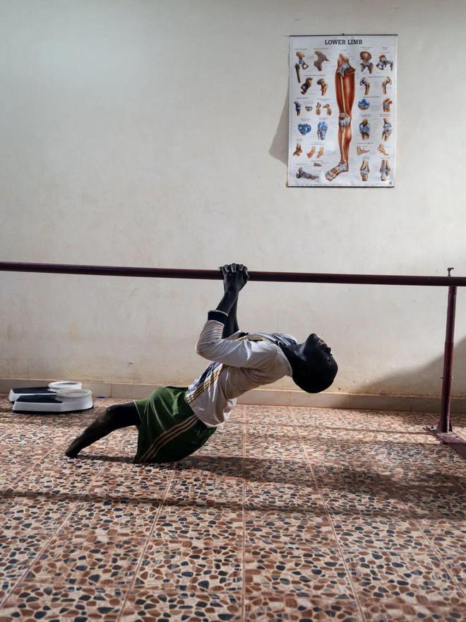 走向自立：在南苏丹通过假肢康复改变命运(图5)