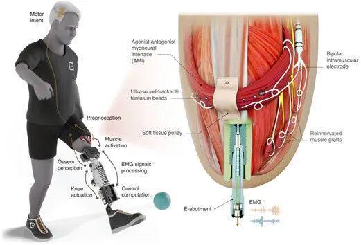 Science正刊：麻省理工学院Hugh Herr 教授成为仿生时代领导者！
