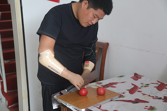 新闻中心 - 优邦假肢矫形器(上海)有限公司(图4)