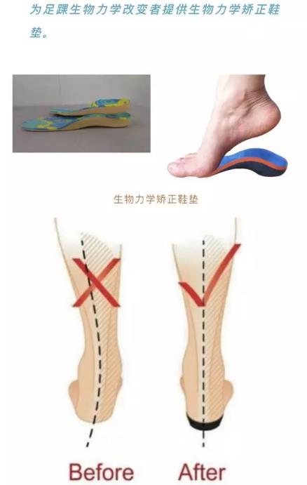 改写叙事：青少年肢体差异、社区可及性与截肢者足球的力量视角